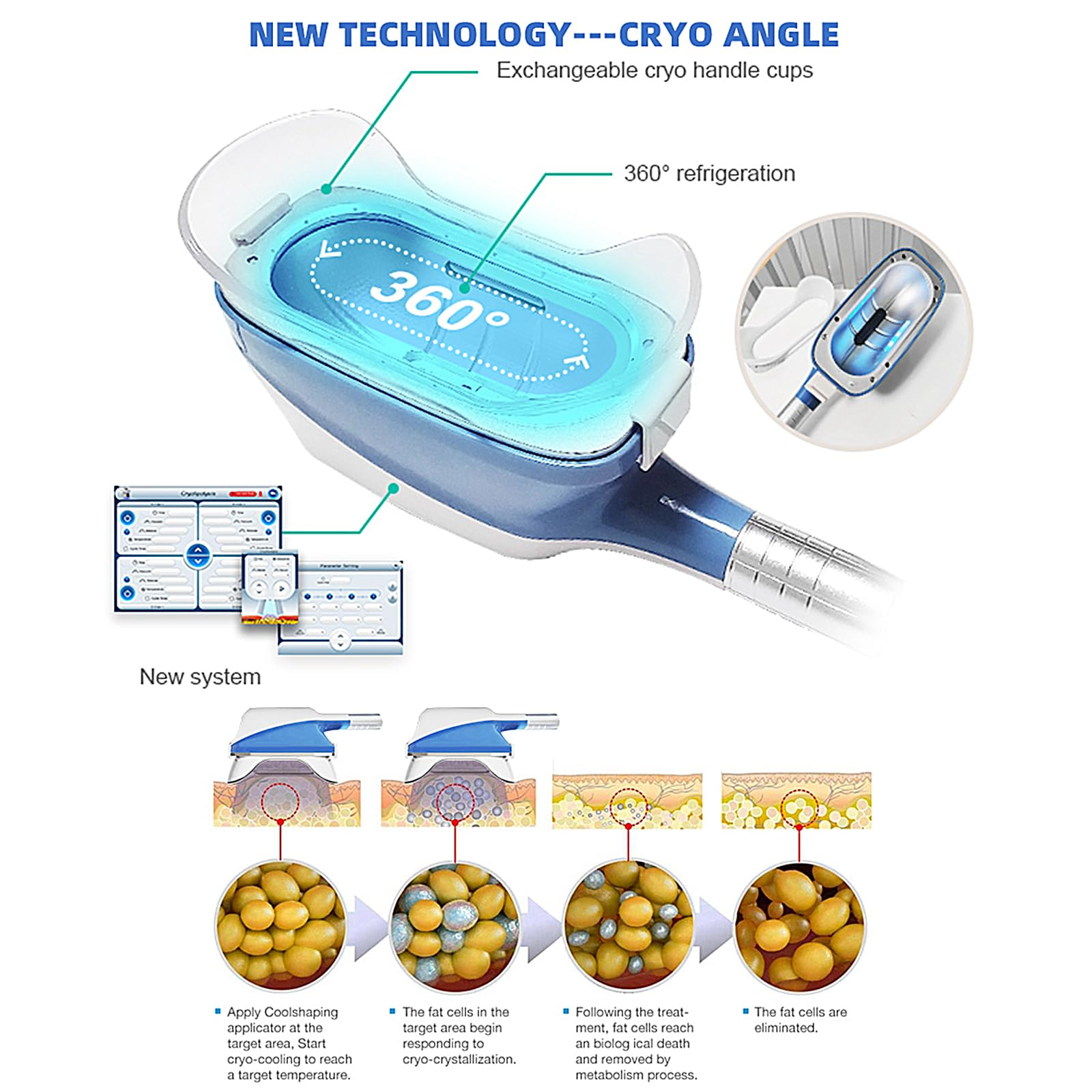Cryo handle
