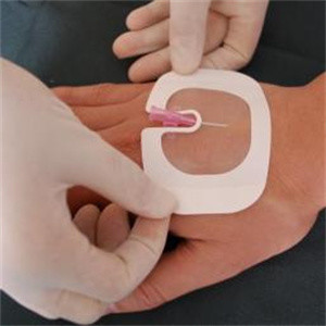 5*6cm Waterproof Transparent Dressing Sterile Adhesive Pads For Wounds