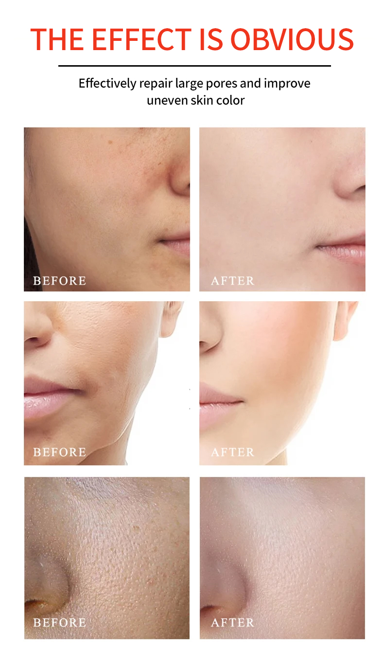 OEM Facial Serum Whitening Anti Wrinkle Vitamin C Serum For Face