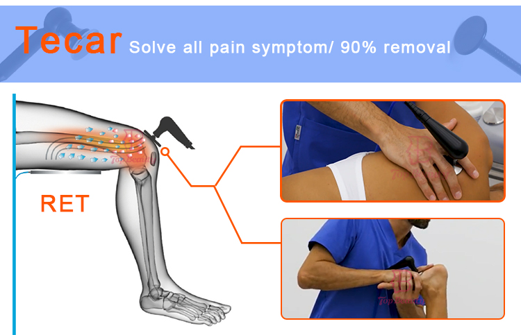 Resistive Rf Tecar Therapy Machine Sports Rehabilitation