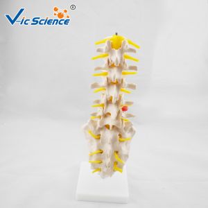 Life Size PVC Lumbar Vertebrae Model With Sacrum / Coccyx And Herniated Disc