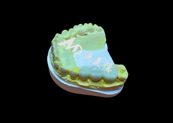 Customized Smooth Surface Zirconia Dental Crown High Biocompatibility Stain