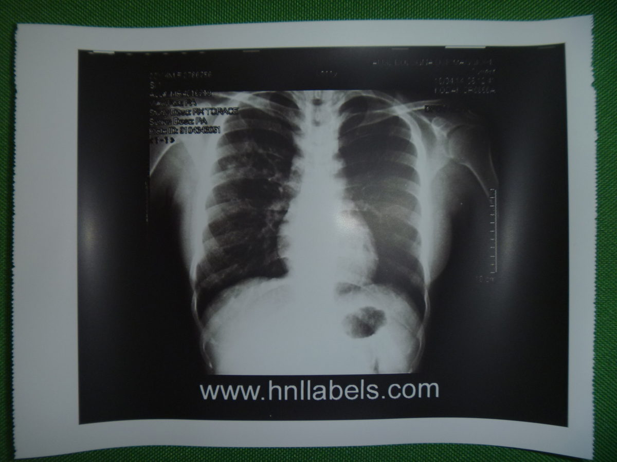 upp-110s,sony ultrasound paper, sony upp-110supp-110s,sony ultrasound paper, sony upp-110supp-110s,sony ultrasound paper, sony upp-110supp-110s,sony ultrasound paper, sony upp-110s