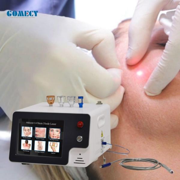 980 1470nm Diode Laser Optical Fiber Body Slimming Machine For Lipolysis Face