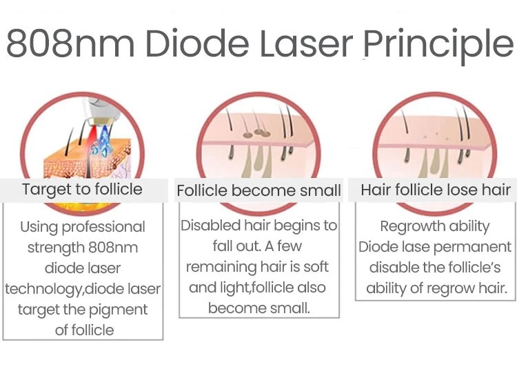 Germany Bar 1200w 1600w Laser Diode 808nm Laser Hair Removal Machine