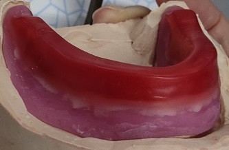 ISO13485 Toothless Dental Wax Rim Other Dental Products