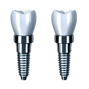  Consistency In Every Crown Our Dental Implant Crown Manufacturing Process Manufactures