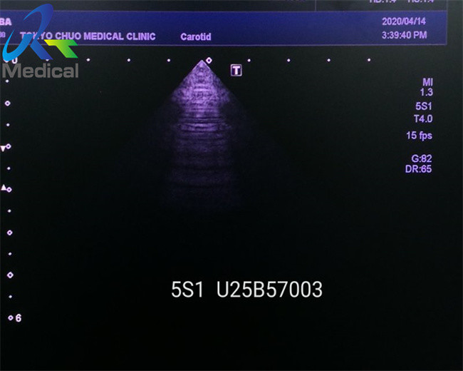 Toshiba PSU-25BT 5S1 Sector Ultrasound Transducer Probe Diagnostic System Medical Instrument