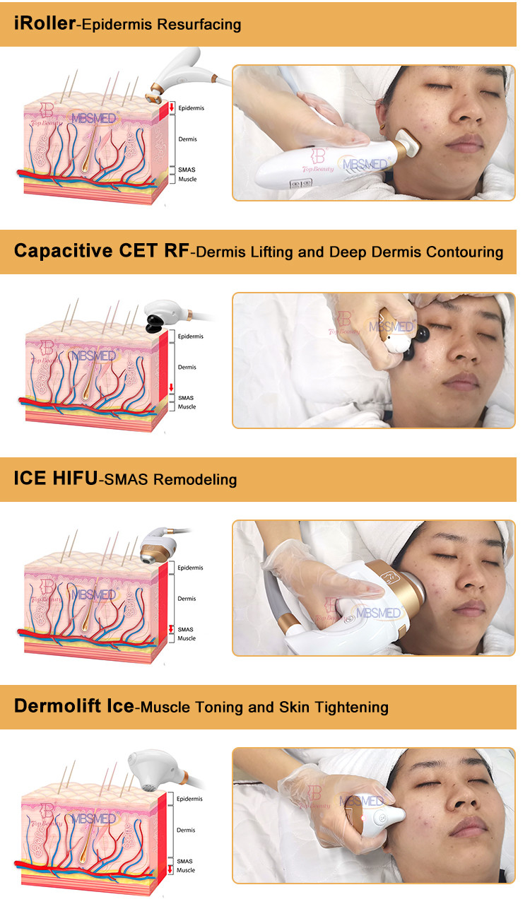 7D 12D 14D ICE HIFU Face Lifting Wrinkle Removal HIFU Machine