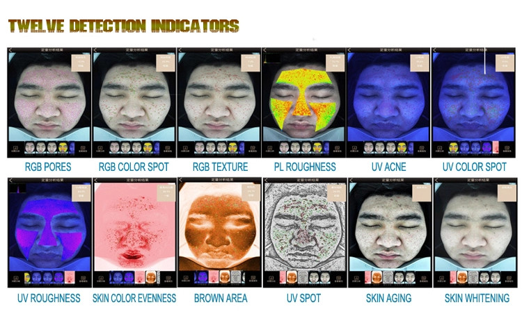 Android System Skin Analysis Machine Salon Big Data Base 3D Testing Facial