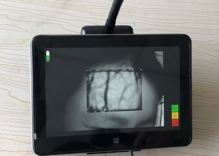 10mm Imaging Depth Desktop Infrared Vein Finder Hospital Medical Equipment