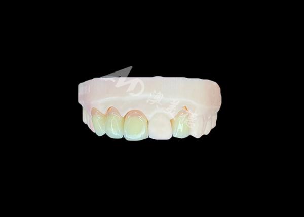 Natural and Comfortable Fit Zirconia Porcelain Crown China Dental Lab Customizab