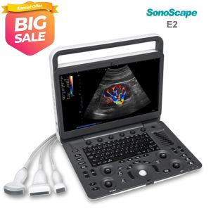 China Sonoscape E2V E2 Veterinary Scanner Portable Color Doppler Ultrasound Machine on sale