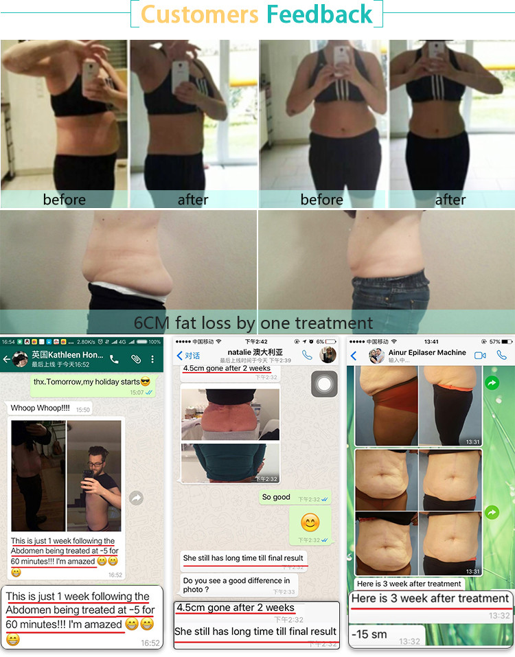 cryogenic treatment services cocoon beauty tighten cryolipolysis system cryo