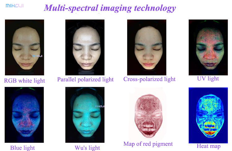 Black/ White Skin Test Analyzer Korean Skin Analyzer Facial Analyzer for Face Target Area