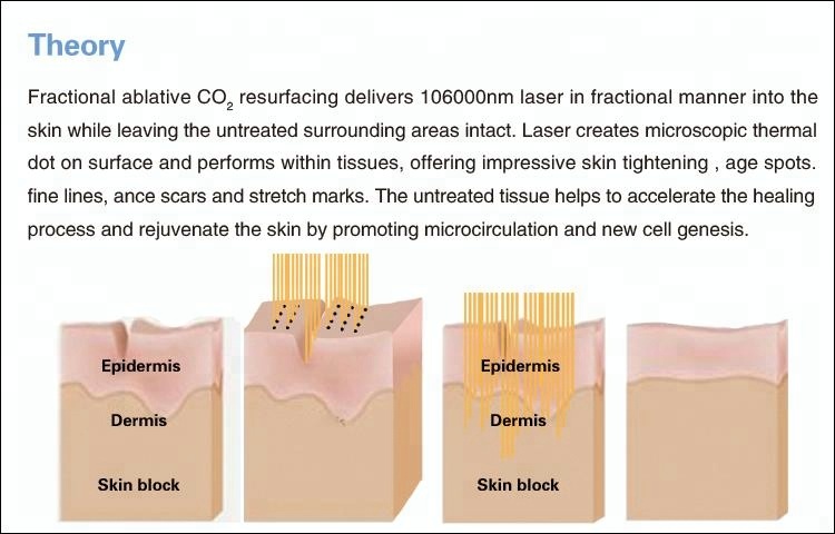 Portable Fractional CO2 Laser Machine 40W 10600nm For Skin Rejuvenation