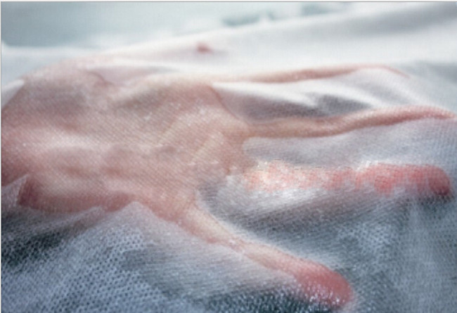 Waterproof Anti-bacterial PP Spunbond Hydrophilic Medical Non Woven Fabric