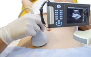  Handheld diagnostic ultrasound scanner EW-B10 with Convex probe C3.5R60 for Human use Manufactures