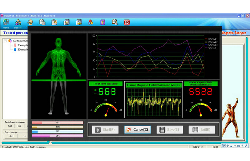 41 Reports Quantum Health Analyzer Machine With Bronze Color