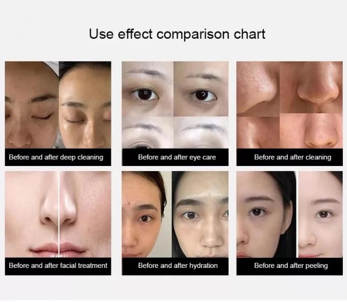 14 In 1 Peeling Hydro Microdermabrasion, Oxygen Jet Aqua Care, Deep Cleansing And Moisturizing Skin, Removes wrinkles