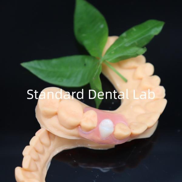 Esthetic Valplast Flexible Dentures with Free Redo Policy in 3 Days China Dental