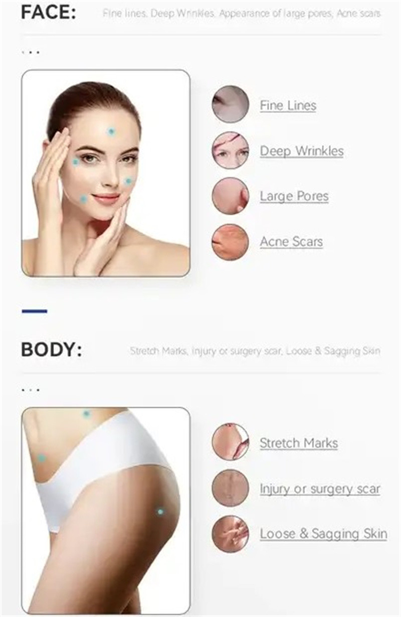 Portable 2 In 1 Fractional Rf Microneedling Machine With Cold Hammer