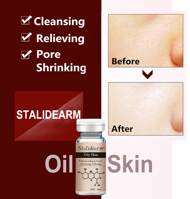 Organic Herbal Serum Anti Acne Customized Label Dermapen Face Essence For Oily Skin