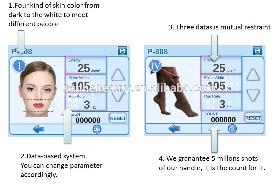 2017 Germany import radiator 808nm diode laser hair removal, permanent hair removal machine