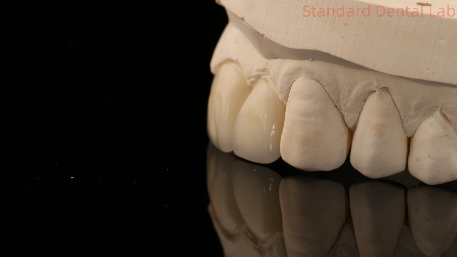 Strong Layered Zirconia Crown And Bridge In Good Esthetics Zirconia Layered China Dental Lab