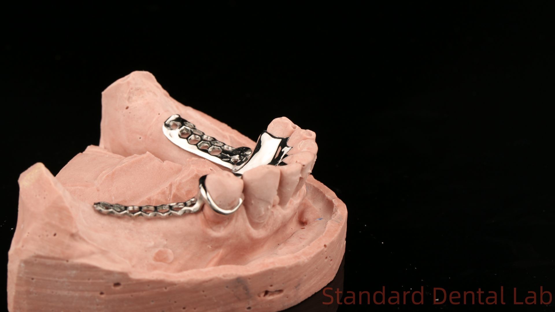 Cobalt Chrome Cast Metal Framework Partial Dentures With Lower Apron Design SDL Dental Lab