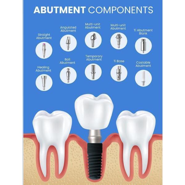 Popularity OEM Dental Implant Prosthetic Accessory Tissue Level Dental Prosthetic Components