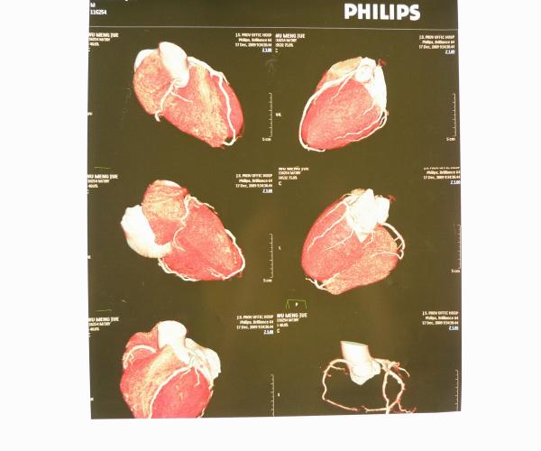 Thin Konida X Ray Diagnostic Imaging Laser Blue Paper For Xray Machine
