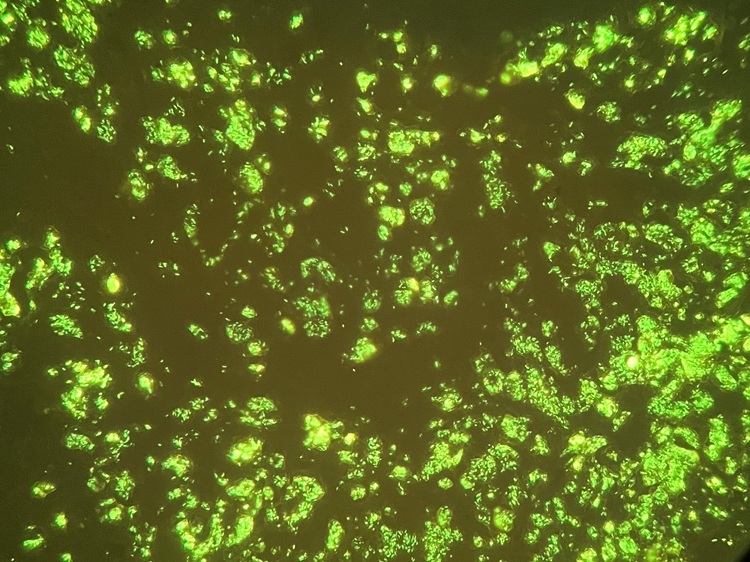 Acid Fast Fluorescence Chromogenic Reagent For Hospital Clinic