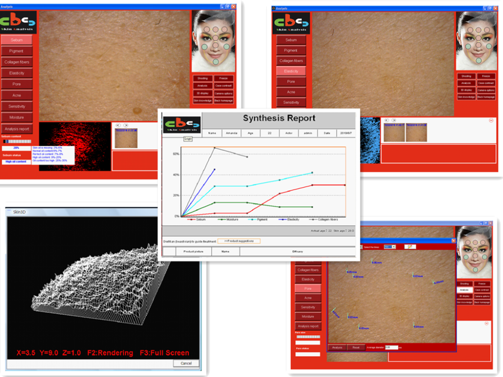 Distributors Wanted Facial Skin Analyzer Machine for Skin Testing/Digital Skin Moisture Analyzer