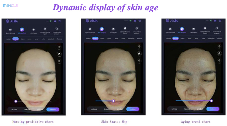 Black/ White Skin Test Analyzer Korean Skin Analyzer Facial Analyzer for Face Target Area