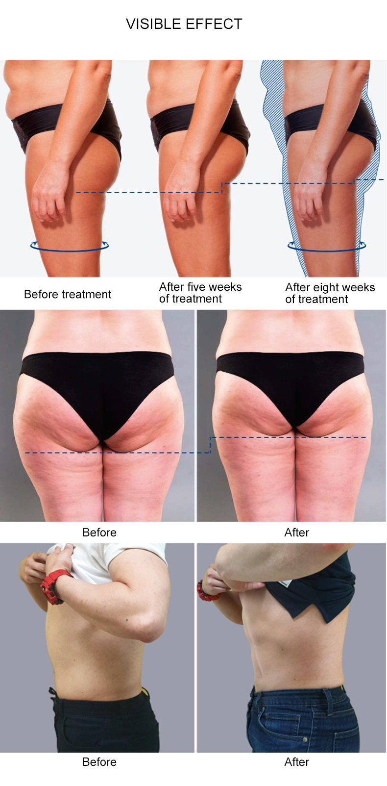 2 In 1 Cellulite Removal / Vacuum RF Cavitation Roller Fat Reduction Weight Loss Slimming Beauty Machine