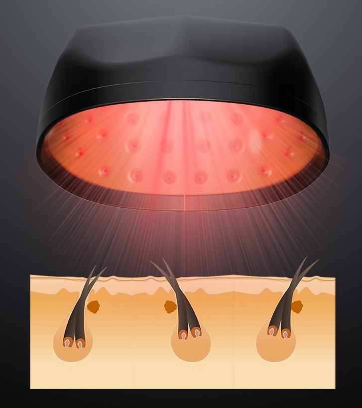 OEM LLLT Laser Hair Growth Caps 650nm Red Light Hat For Hair Regrowth