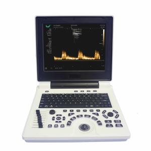 ISO Electron Scan Notebook USG Scan Machine For Obstetrics And Gynecology