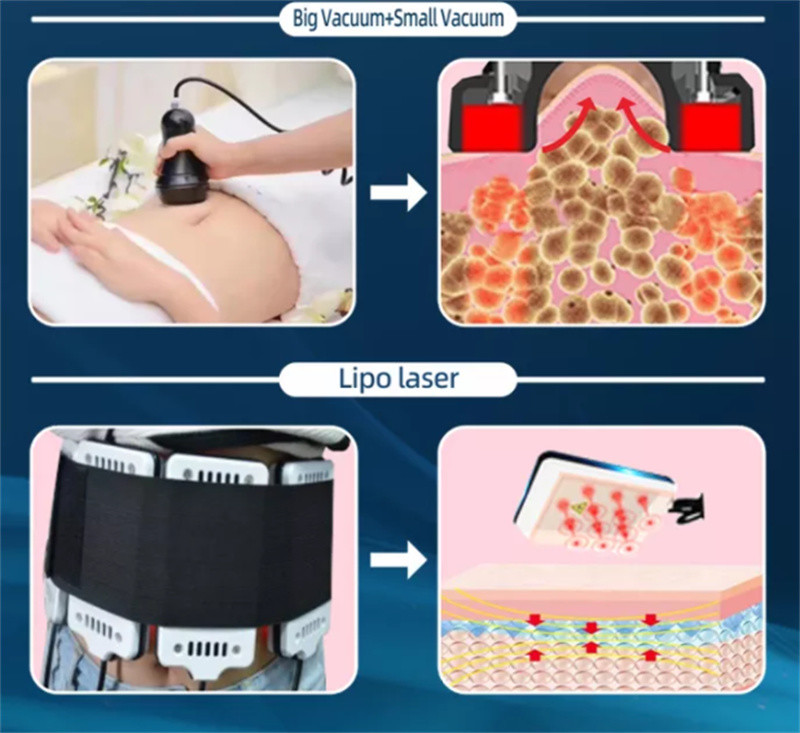 Rf 40k Cavitation Body Slimming Machine Ultrasonic Lipo Laser Pads