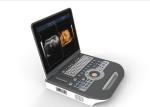  Medical Ultrasound Machine Portable Ultrasound Scanner 4d Ultrasound Equipment Manufactures