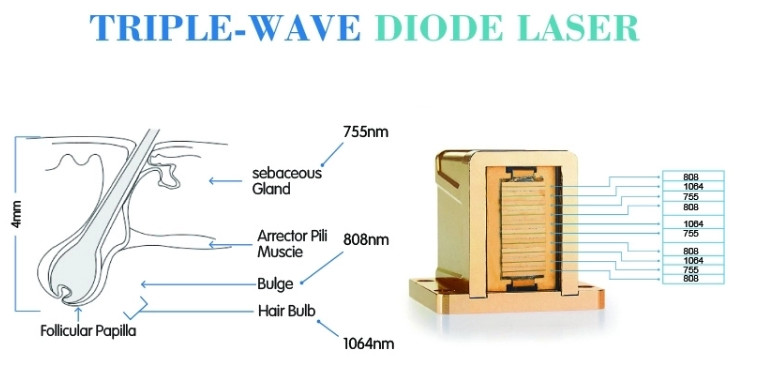 best hair removal system 808 diode laser hair removal machine for sale