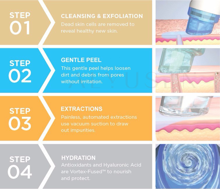 Bubble Aqua Dermabrasion Machine , H2O2 Hydra Oxygen Facial Beauty Machine