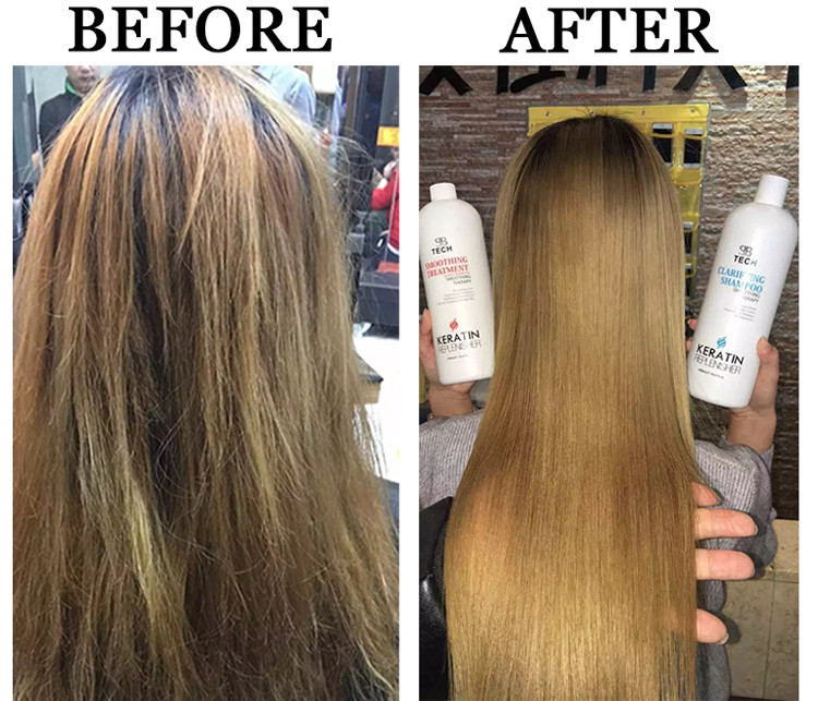 240ml Natural Dandruff Hair Shampoo Apple Cider Vinegar Hair Care
