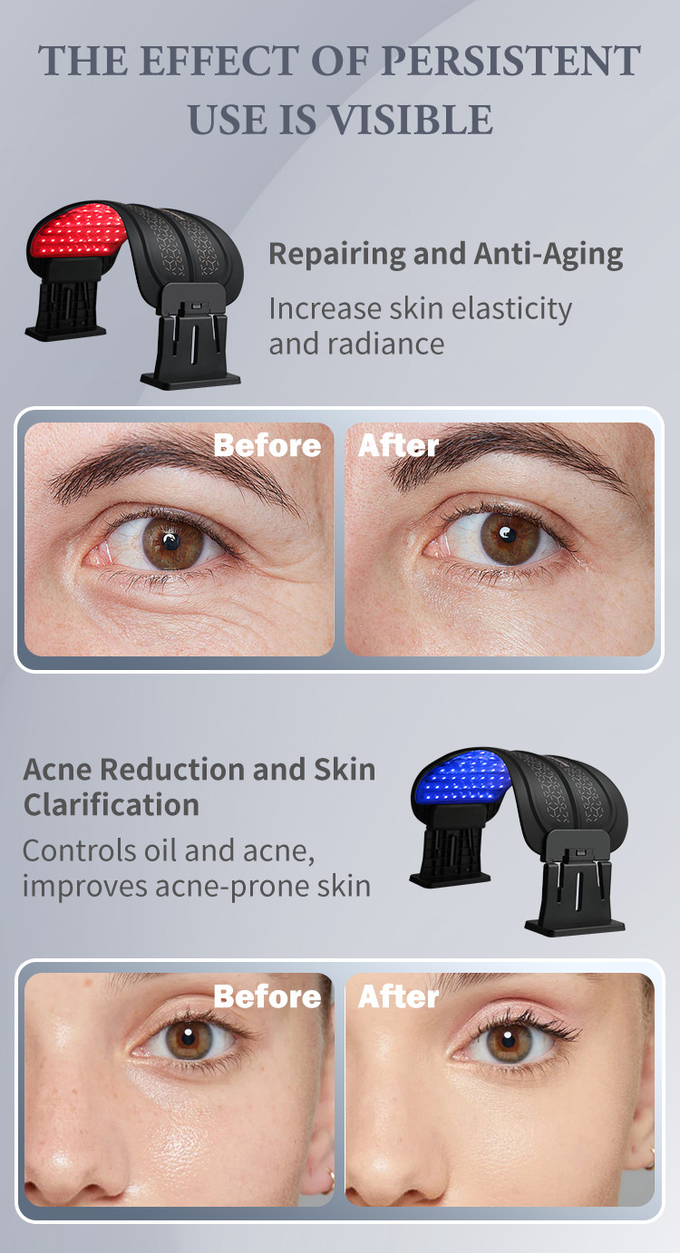 5 Color Aesthetic Spectrometer With Infrared Anti Aging PDT LED Light Machine