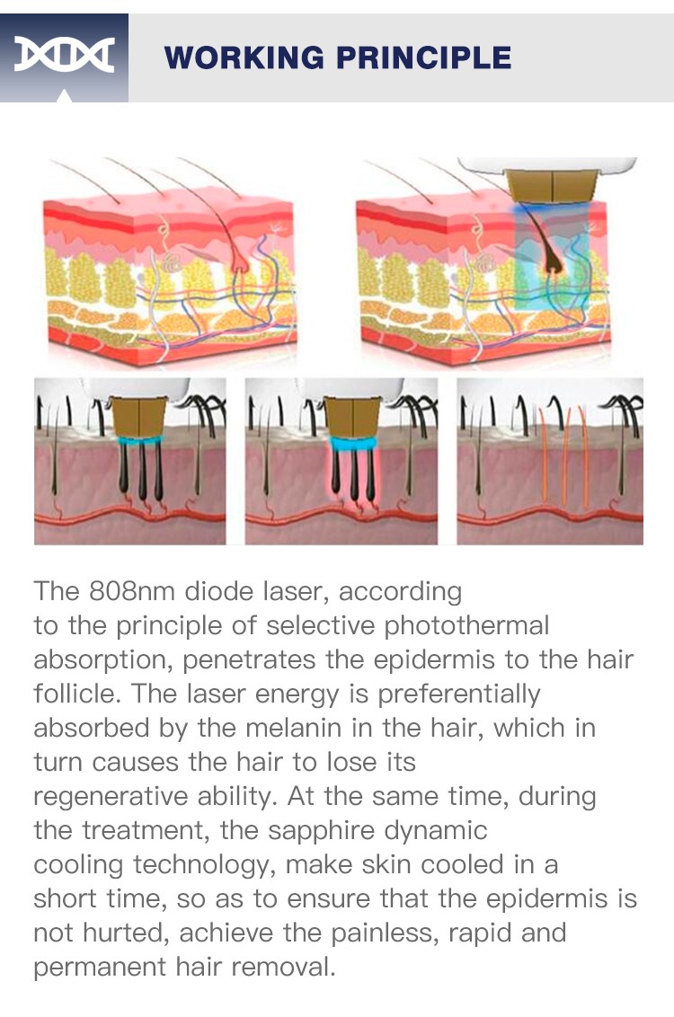 Mens Laser Hair Removal for Men Permanent 808 Hair Removal Device Ice Platinum Skin Facial Hair Remover Machine