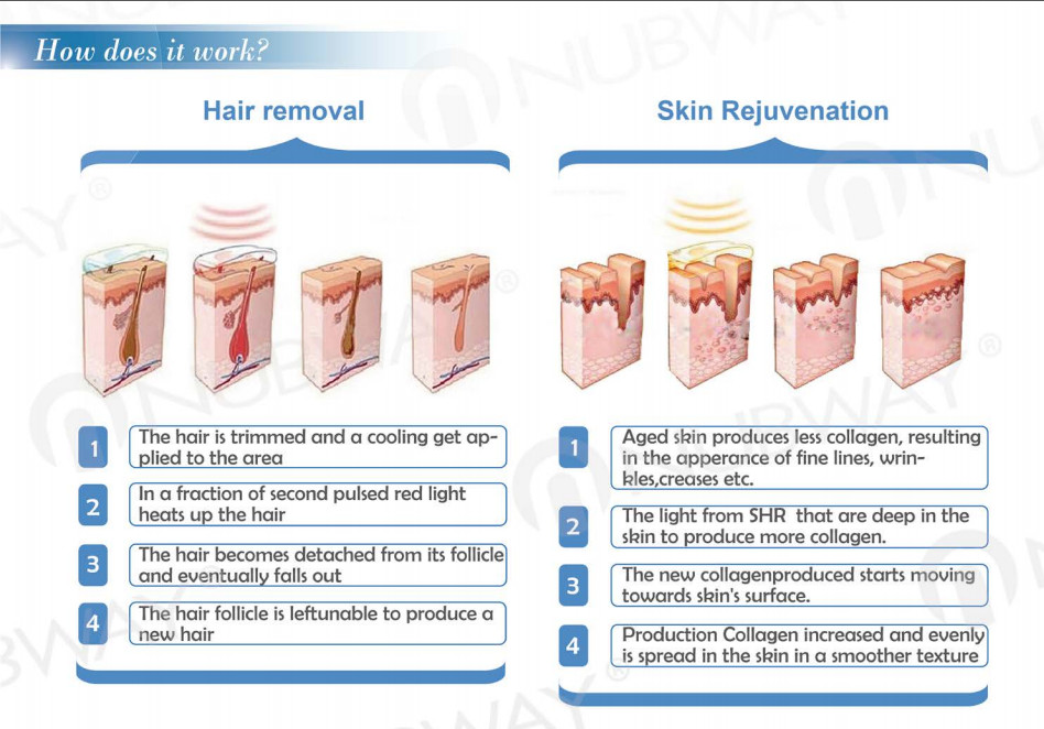FDA approved ipl laser machine ipl laser hair removel machine for sale lumenis ipl quantum