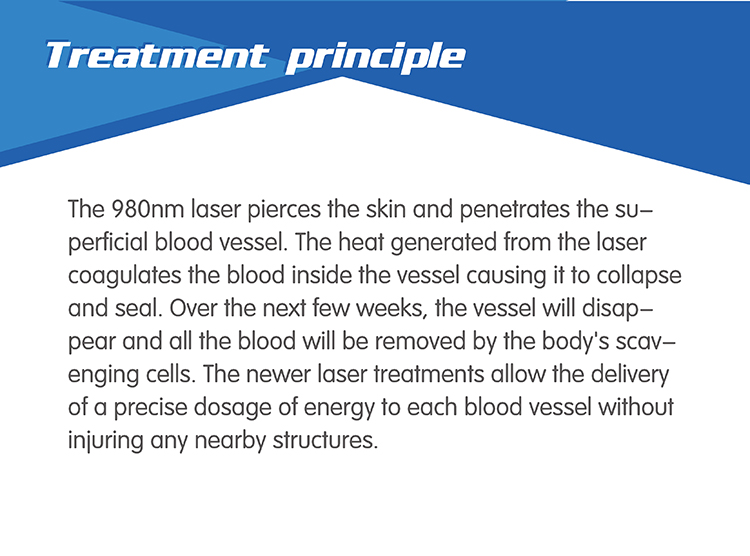 Painfree and Permanent 980nm laser diode laser hair removal machine
