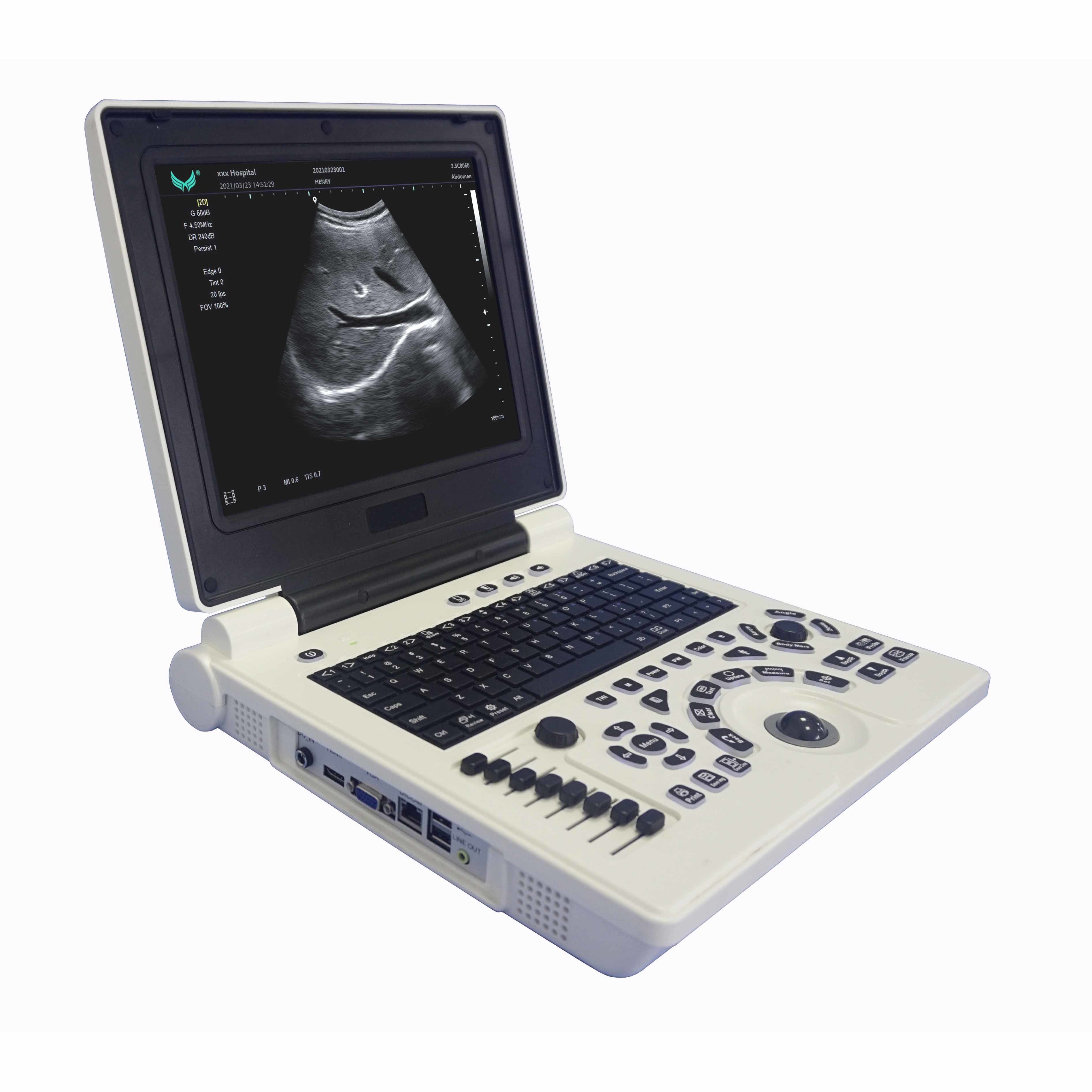  USG OB GYN Portable USG Machine IMT Automatic Measurement Manufactures