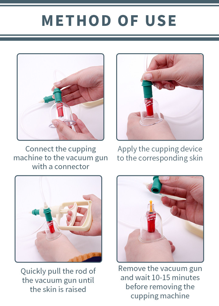 Plastic Therapy Hijama Cupping Set Big Size Vacuum Suction Tools