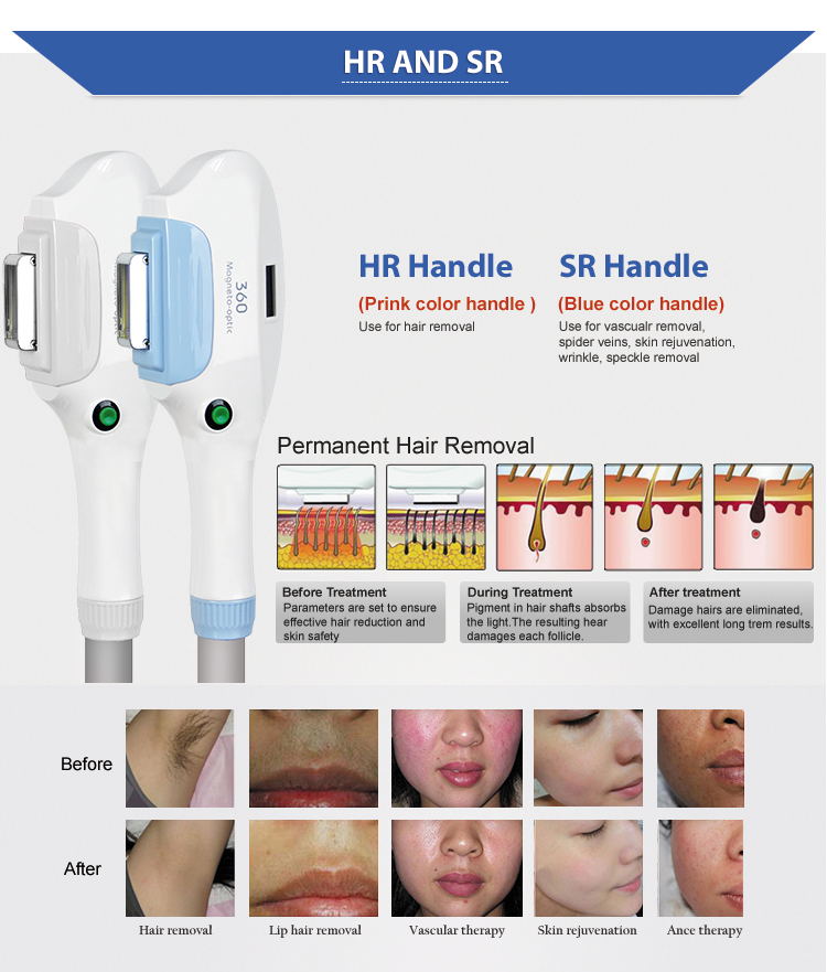 D-813 IPL 3 In 1 multifunctional OPT Beauty Machine Pigment Removal device RF Skin Lift Whitening equipment for women
